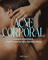 Acne Corporal: Porque Acontece e Como Livrar-se Dela Naturalmente - MPL beauty