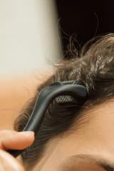 dermaroller couro cabeludo - Ferramentas Cabelo - MPL beauty